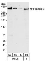 Filamin B Polyclonal Antibody