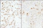 FOXK1 Polyclonal Antibody
