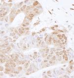 FOXK2 Polyclonal Antibody