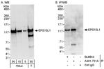 EPS15L Antibody in Western Blot (WB)