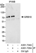 GRB10 Antibody in Immunoprecipitation (IP)