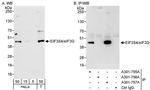 eIF3G/EIF3S4 Antibody in Western Blot (WB)