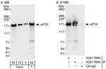 eIF3X Antibody in Western Blot (WB)