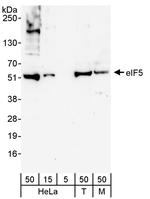 eIF5 Polyclonal Antibody