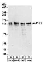 PHF8 Polyclonal Antibody