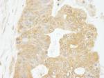 eIF4G1/eIF4GI Polyclonal Antibody