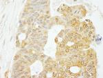eIF4G1/eIF4GI Polyclonal Antibody