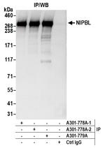 NIPBL Polyclonal Antibody