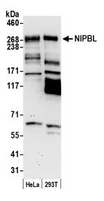 NIPBL Polyclonal Antibody
