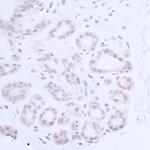 XPA Antibody in Immunohistochemistry (Paraffin) (IHC (P))