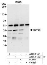 NUP35 Antibody in Immunoprecipitation (IP)