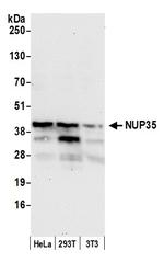 NUP35 Antibody in Western Blot (WB)