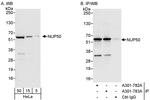 NUP50 Antibody in Western Blot (WB)