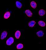 NUP153 Polyclonal Antibody