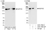 NUP153 Antibody in Western Blot (WB)