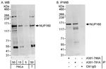NUP160 Polyclonal Antibody