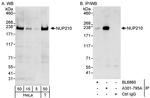NUP210 Polyclonal Antibody