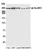 RanBP2 Polyclonal Antibody