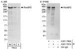 RanBP2 Polyclonal Antibody
