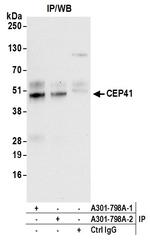 CEP41 Antibody in Immunoprecipitation (IP)