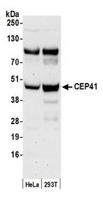 CEP41 Polyclonal Antibody