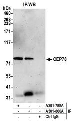 CEP78 Antibody in Immunoprecipitation (IP)