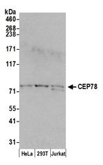 CEP78 Polyclonal Antibody