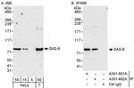 SAS-6 Polyclonal Antibody