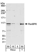 RanBP8 Polyclonal Antibody