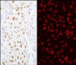 ZCCHC8 Polyclonal Antibody