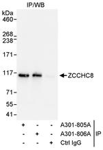 ZCCHC8 Antibody in Immunoprecipitation (IP)