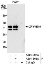 ZFYVE19 Polyclonal Antibody