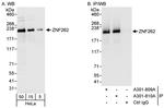 ZNF262 Antibody in Western Blot (WB)