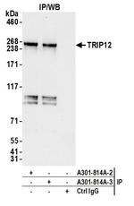 TRIP12 Antibody in Immunoprecipitation (IP)