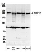 TRIP12 Antibody in Western Blot (WB)