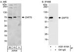 ZAP70 Antibody in Western Blot (WB)