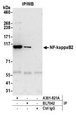 NF-kappaB2 Antibody in Immunoprecipitation (IP)