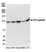 NF-kappaB2 Polyclonal Antibody