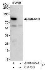 IKK-beta Antibody in Immunoprecipitation (IP)