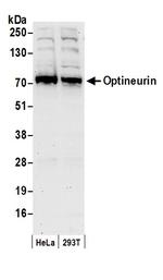 Optineurin Polyclonal Antibody
