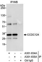 CCDC124 Polyclonal Antibody