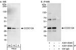 CCDC124 Polyclonal Antibody