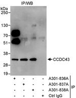 CCDC43 Polyclonal Antibody