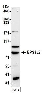 EPS8L2 Polyclonal Antibody