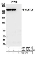 GCN1L1 Antibody in Immunoprecipitation (IP)
