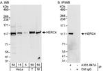 HERC4 Polyclonal Antibody