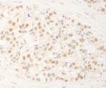 NRBF2 Antibody in Immunohistochemistry (Paraffin) (IHC (P))