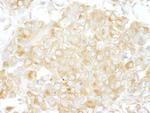 Cdc42GAP Antibody in Immunohistochemistry (Paraffin) (IHC (P))