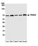 TRIM25 Polyclonal Antibody