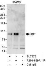 UBF Polyclonal Antibody